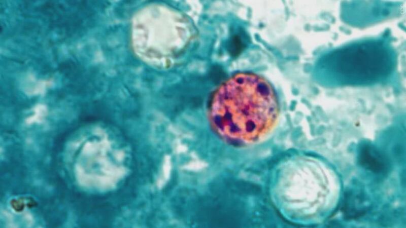 Local health experts explain Cyclosporiasis and rise in southeast Michigan, northwest Ohio